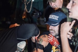 West Allis man shot during Kenosha protests recovers in Milwaukee hospital
