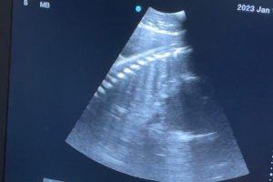 Zahara's ultrasound