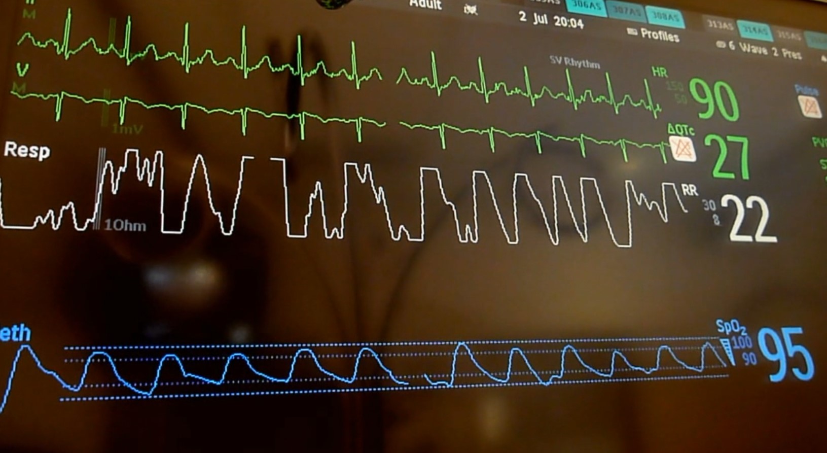 heart monitor.jpg