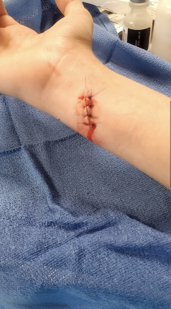 Razor Blade cut 