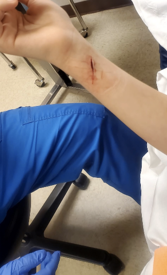 Razor blade cut 
