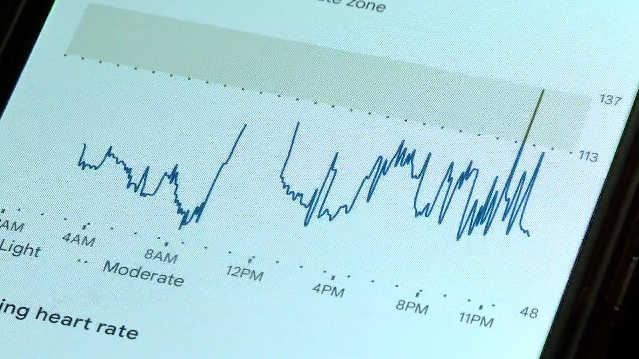 pacer heartbeat.jpg