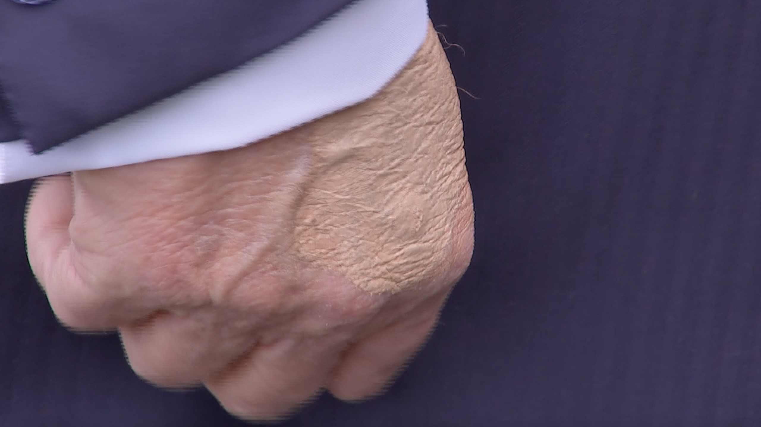 What appears to be makeup covering marks on President Donald Trump's hand as he speaks to reporters.